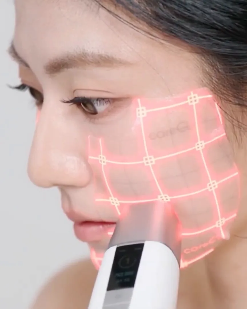 Rejilla luminosa sobre la mejilla con el TECH FIT y el dispositivo de pie